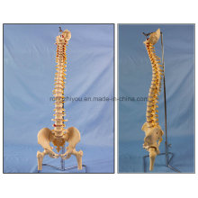 Klassisches flexibles Wirbelsäulen-Skelettmodell mit Femurköpfen